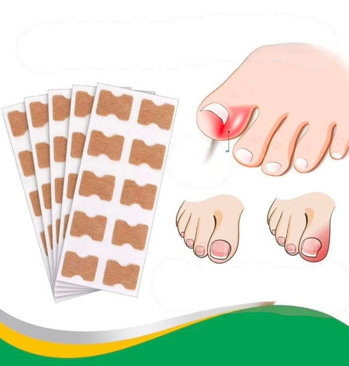 NailRestore™ - Di adiós al dolor y las uñas encarnadas