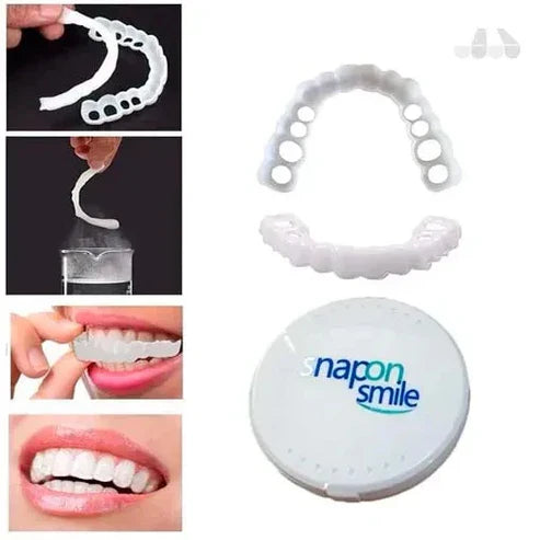PerfectSmile™ by Snap on Smile