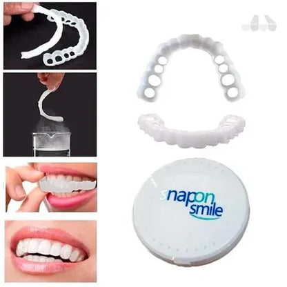 PerfectSmile™ by Snap on Smile