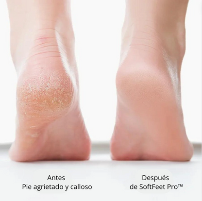 SoftFeet Pro™: ¡Pies Relucientes al Instante! ✨