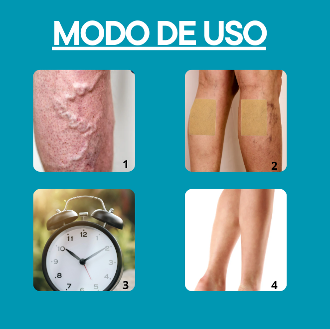 Parches para Varices VEINS🦵 - Alivia el dolor y revitaliza tus piernas✨