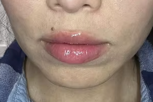 Mónica Pinto, San Pedro de la Paz, Biobio