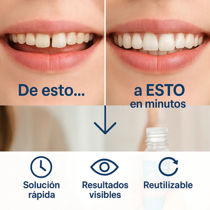 InstantSmile™ - Sonrisa soñada en minutos