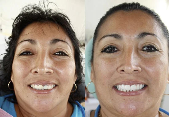 Laura Méndez, Puente Alto