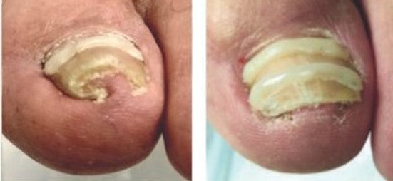 Carlos Muñoz – La Florida