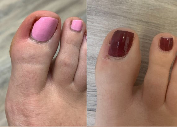 Javiera Fernández – Ñuñoa