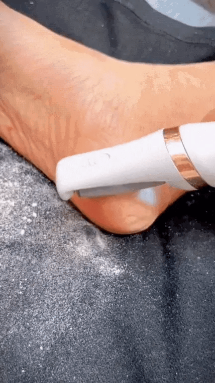 SoftFeet Pro™: ¡Pies Relucientes al Instante! ✨