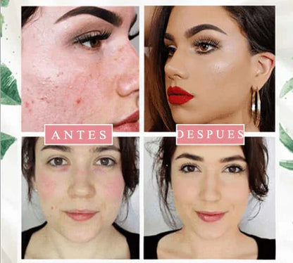 Colagen Glow wear™ by BB Cream Deluxe - La Belleza en tu Tono Perfecto 🌟